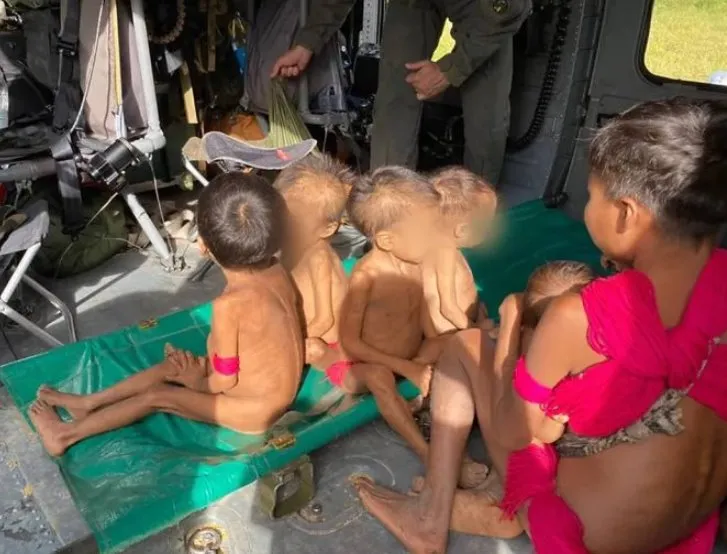 Mortes e miséria: Malária devasta Terra Indígena Yanomami em Roraima e STF entra no caso